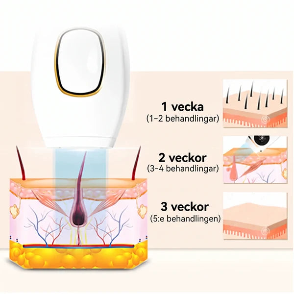 Depiladora IPL Luz Pulsada Reduce Vello
