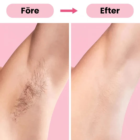 Depiladora IPL Luz Pulsada Reduce Vello