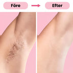 Depiladora IPL Luz Pulsada Reduce Vello